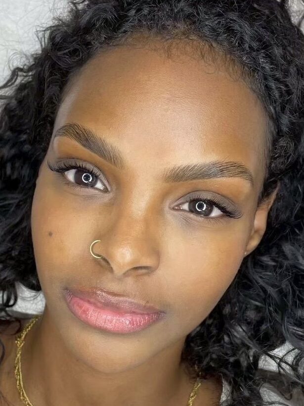 Brow Lift